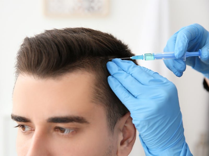 10 Best Hair Loss Treatments for Men