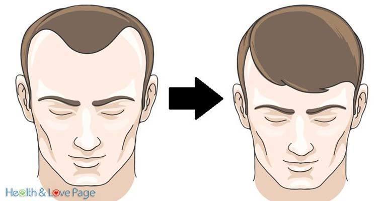 10 Foods that Reverse Hair Loss in No Time!