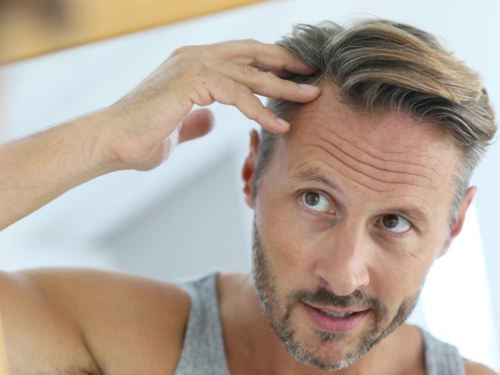 10 Ways to Prevent Hair Loss in Men