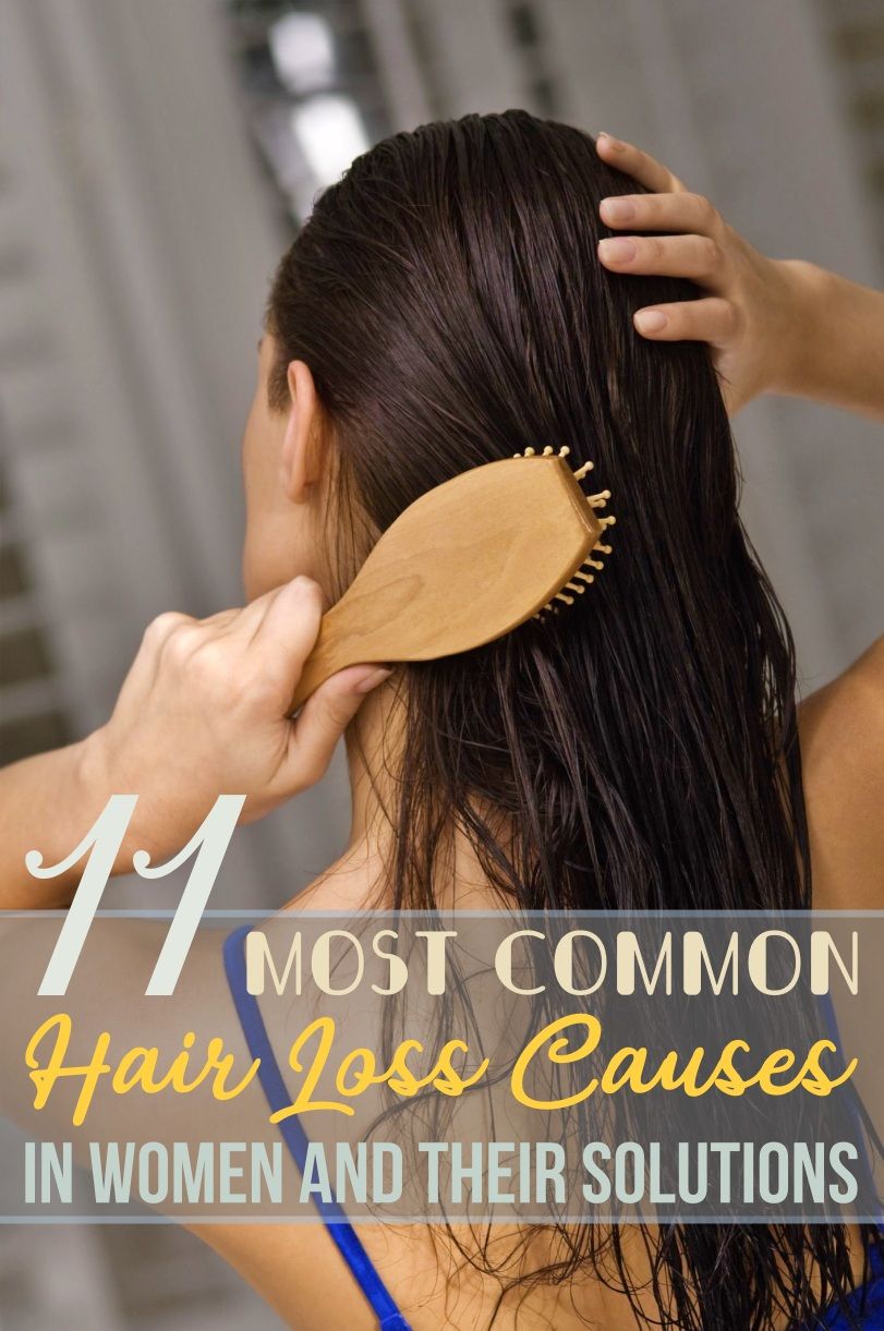 11 Most Common Hair Loss Causes in Women and Their ...