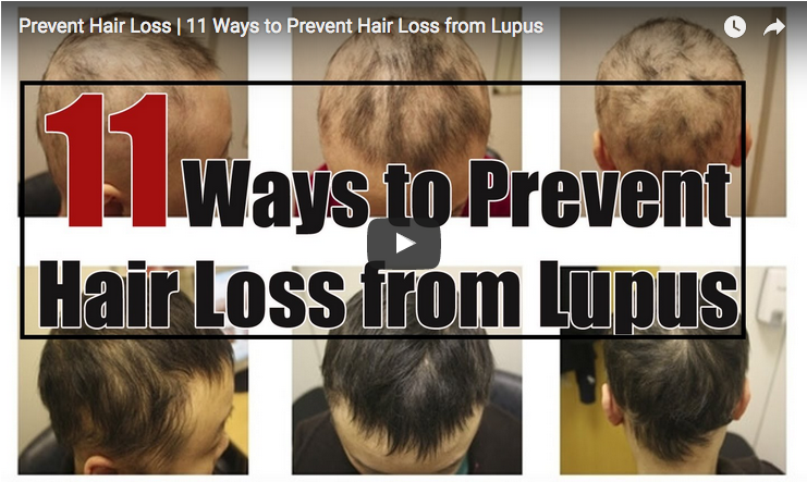 11 Tips to Help Prevent Lupus