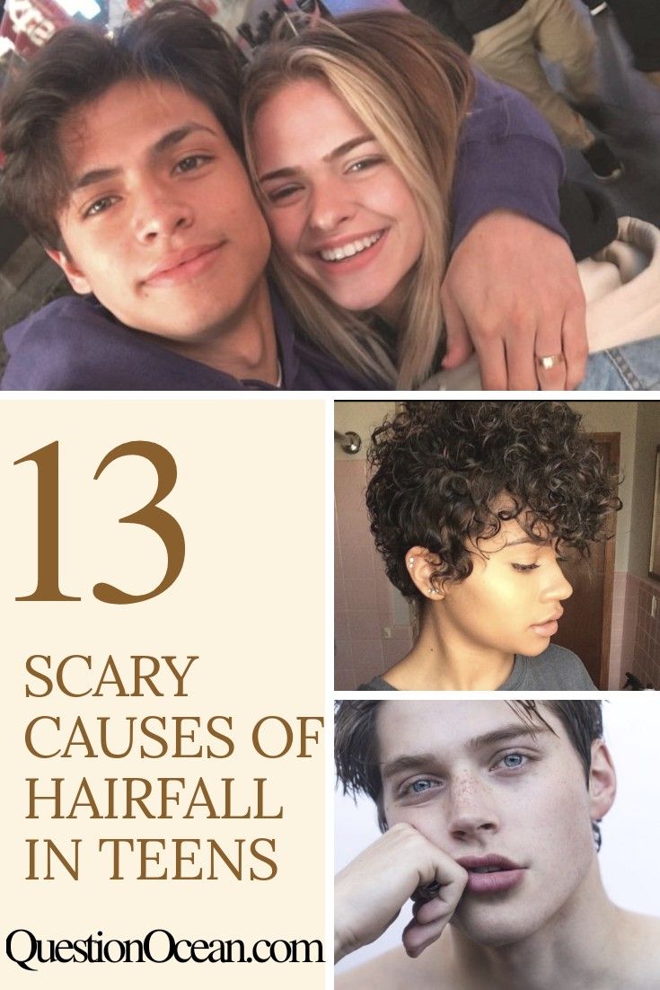 13 Scary causes of hair fall in teenage males and females