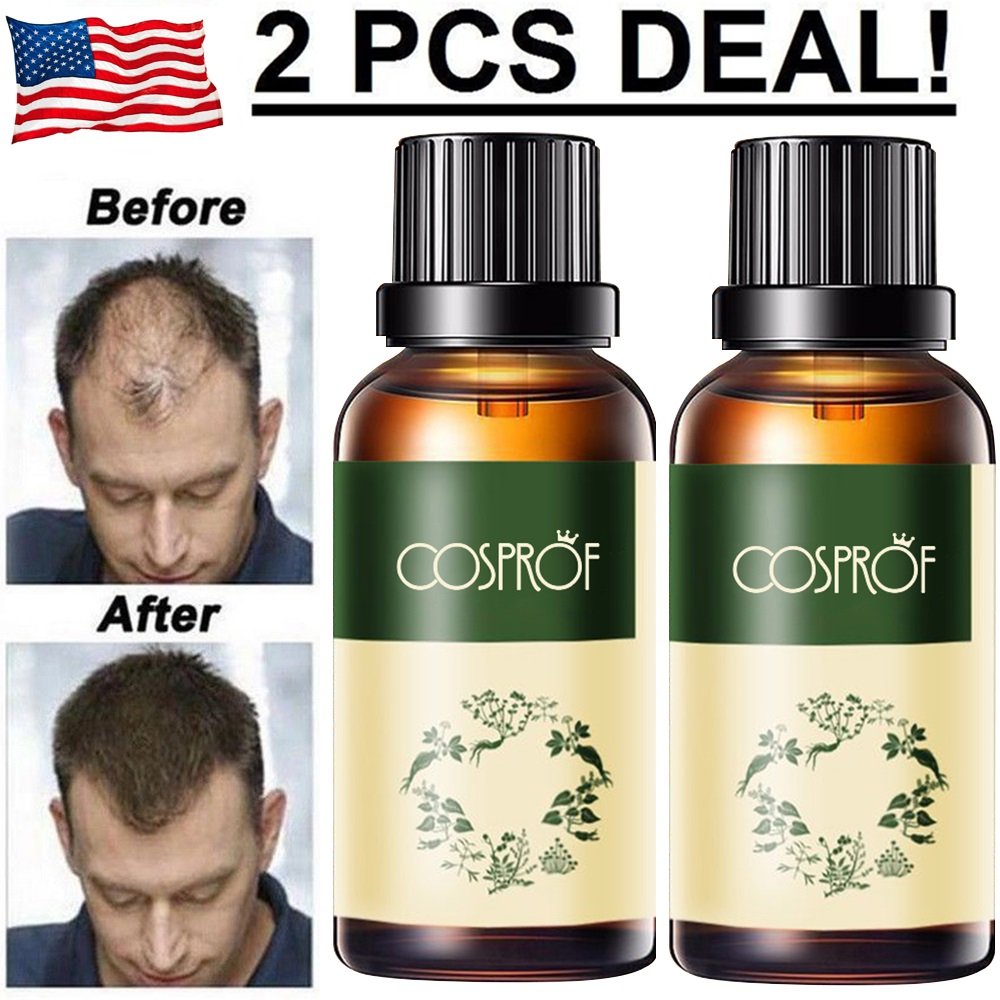 2 Pack Hair Growth Products For Men Women Natural Oil Serum Loss Grow ...