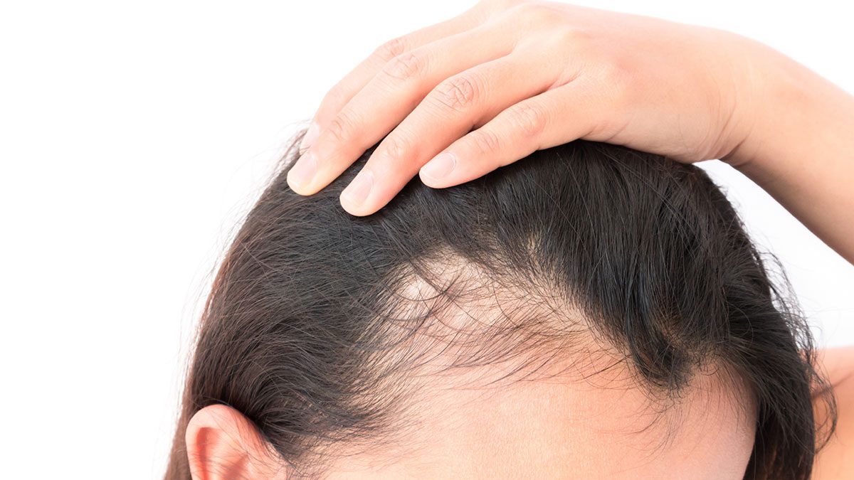 21 Reasons for Your Itchy Scalp