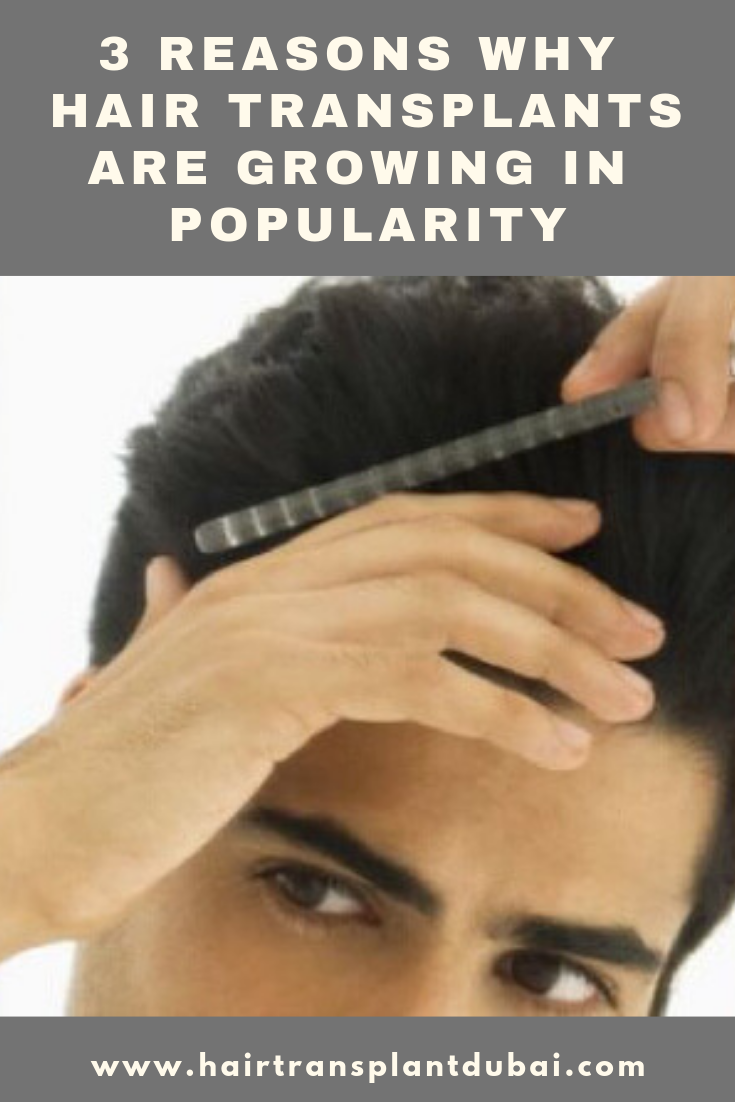 3 Reasons Why Hair Transplants are growing in Popularity ...