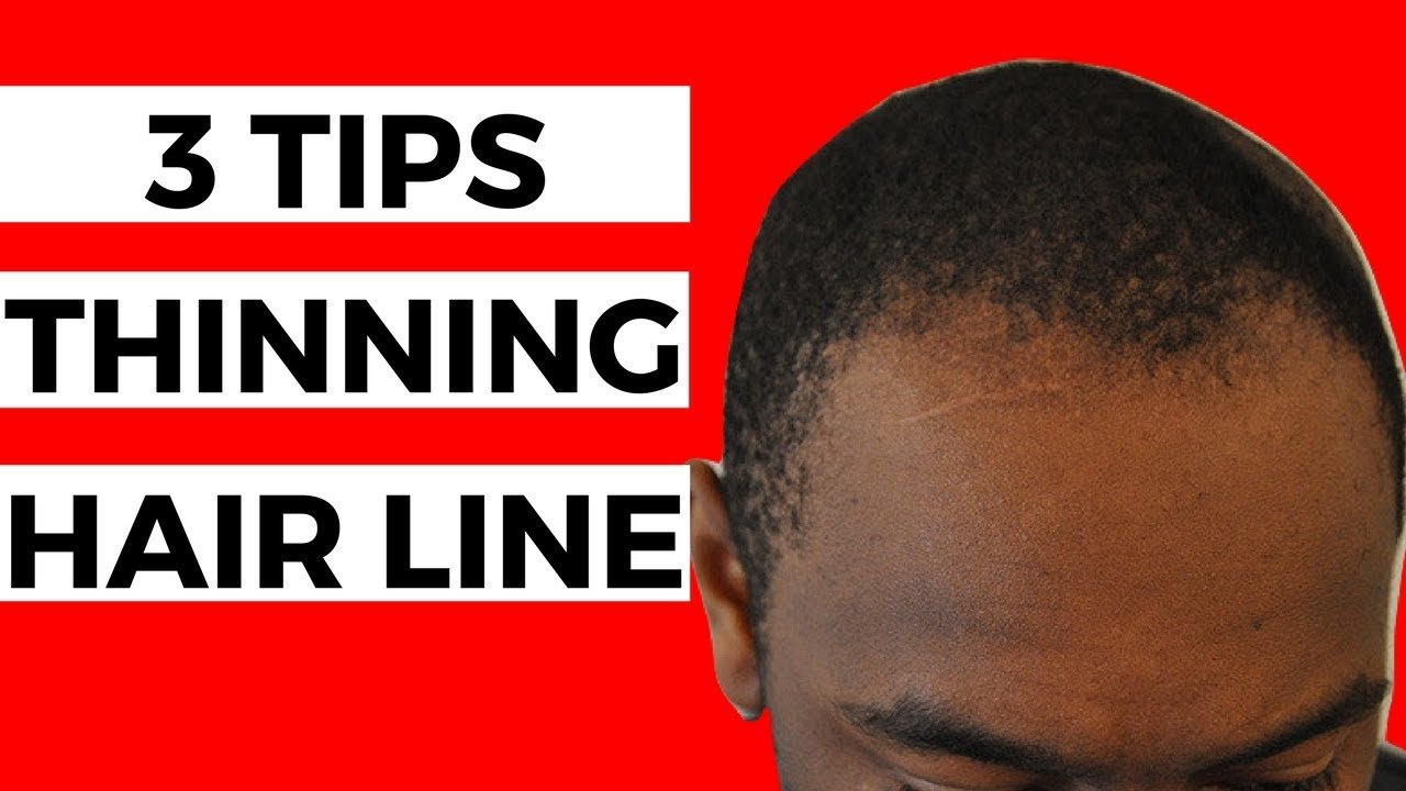 3 Tips For THINNING Hair Line