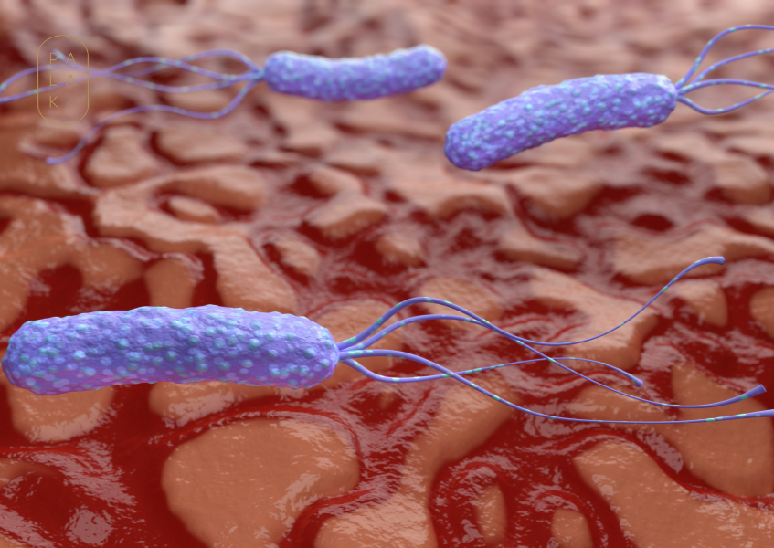 4 Real Causes of H Pylori Infection And Its Natural ...
