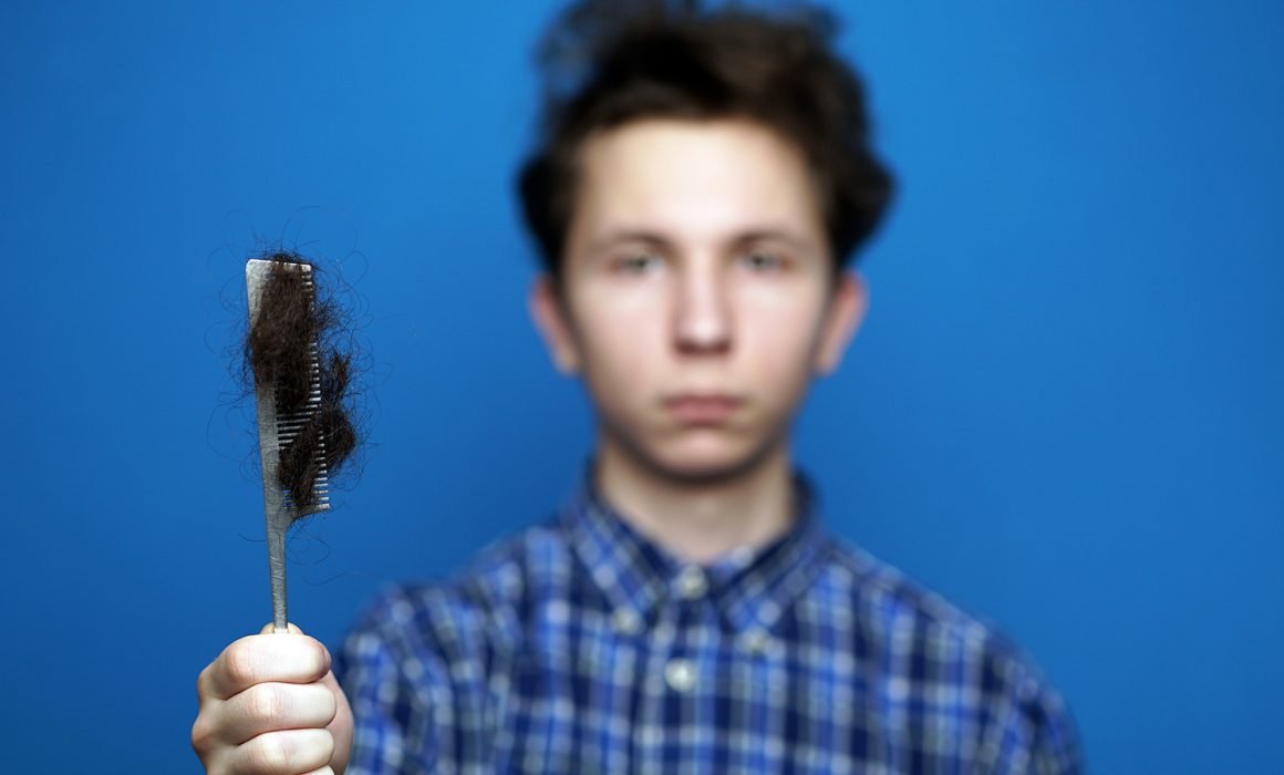 5 Common Causes For Hair Loss In Teenage Boys