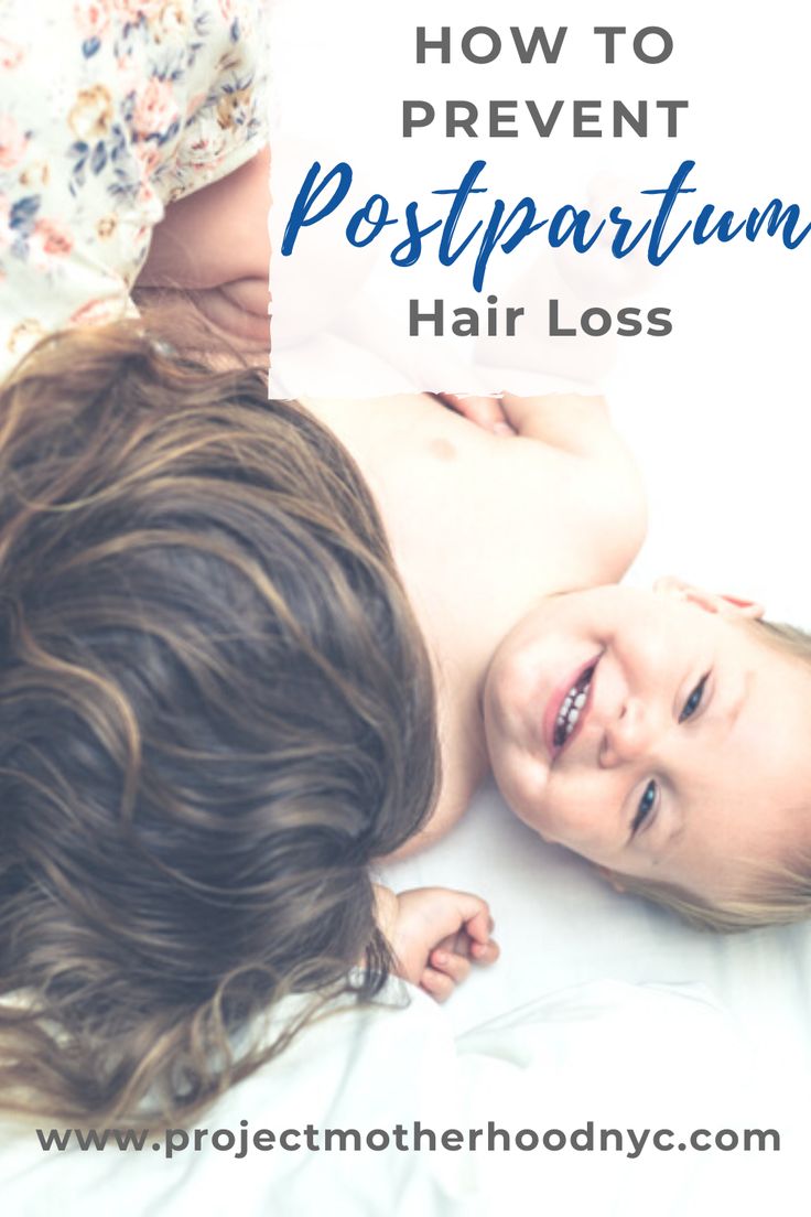 5 Easy Ways To Prevent Postpartum Hair Loss in 2020 ...