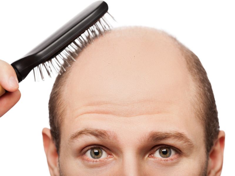 5 foods that can stop balding