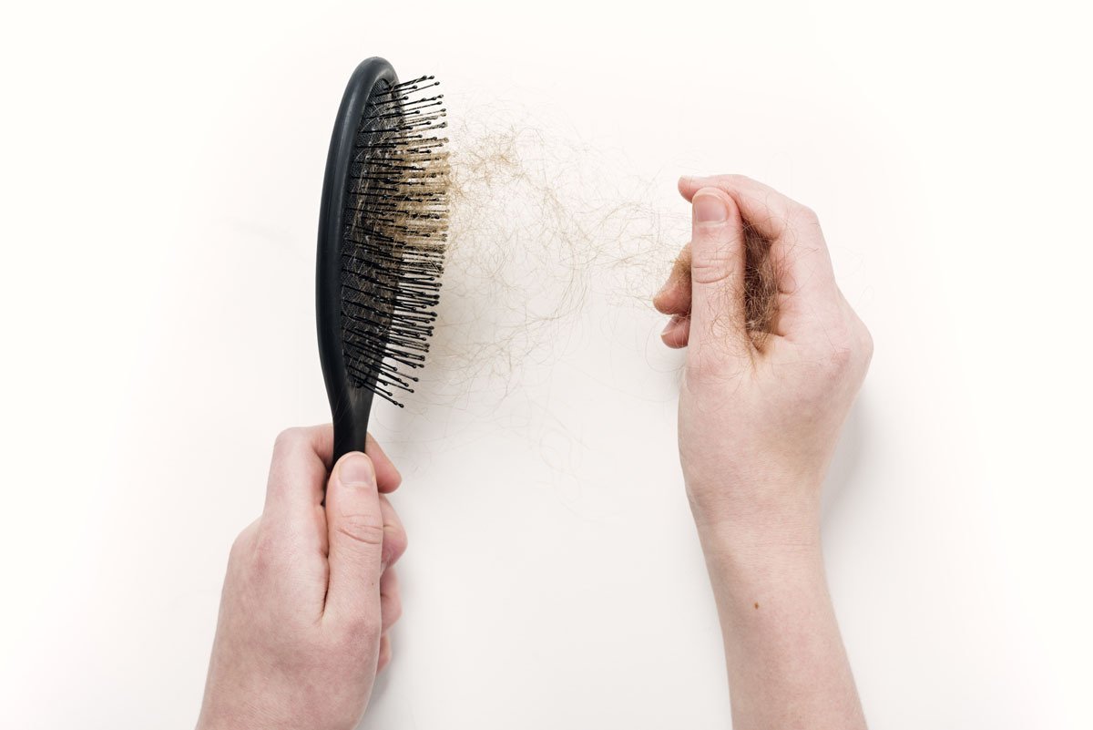 5 Questions You Have About Hair Loss