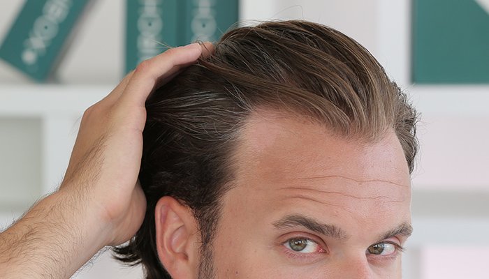 6 Grooming Products That Fight Hair Loss or Volumize ...