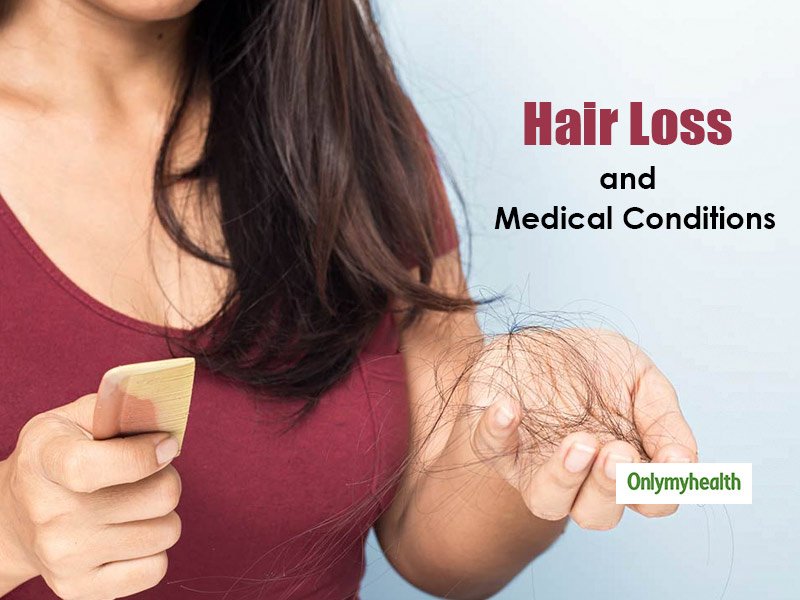 6 Medical Conditions That May Cause Hair Loss