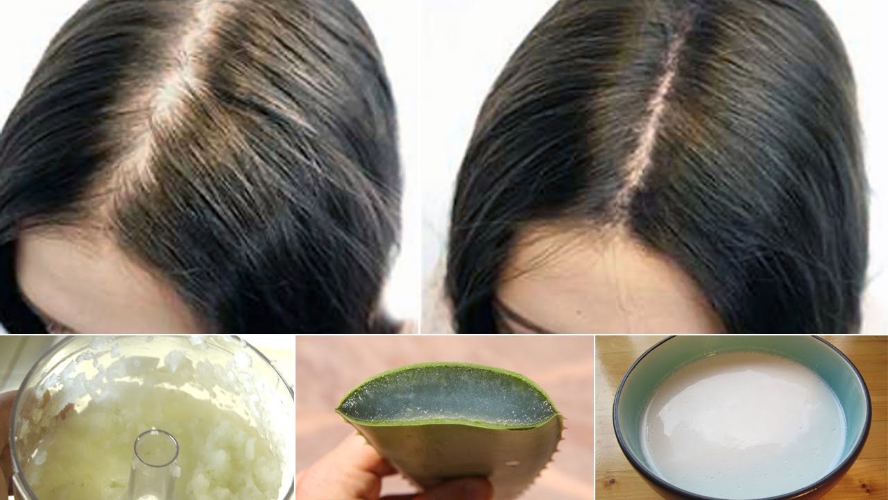 6 Proven Home Remedies for Hair Loss