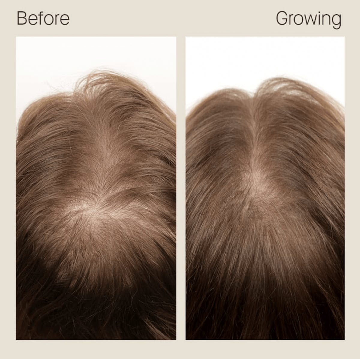 8 Women Who Took Control Of Hair Thinning With Nutrafol