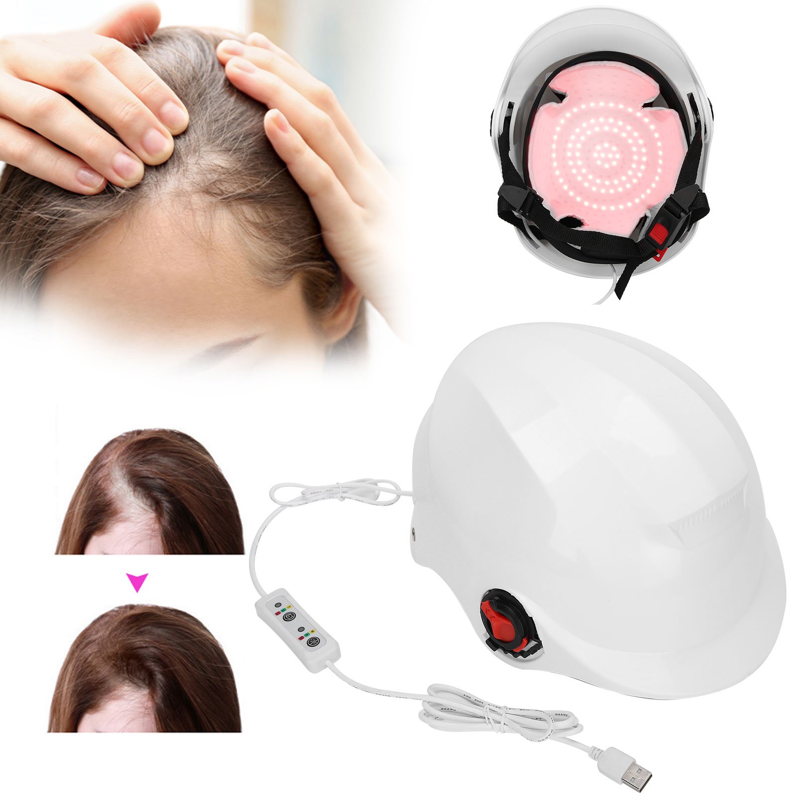 94/280Lamp Beads Red Light Therapy Hair Loss Treatment Device Hair ...