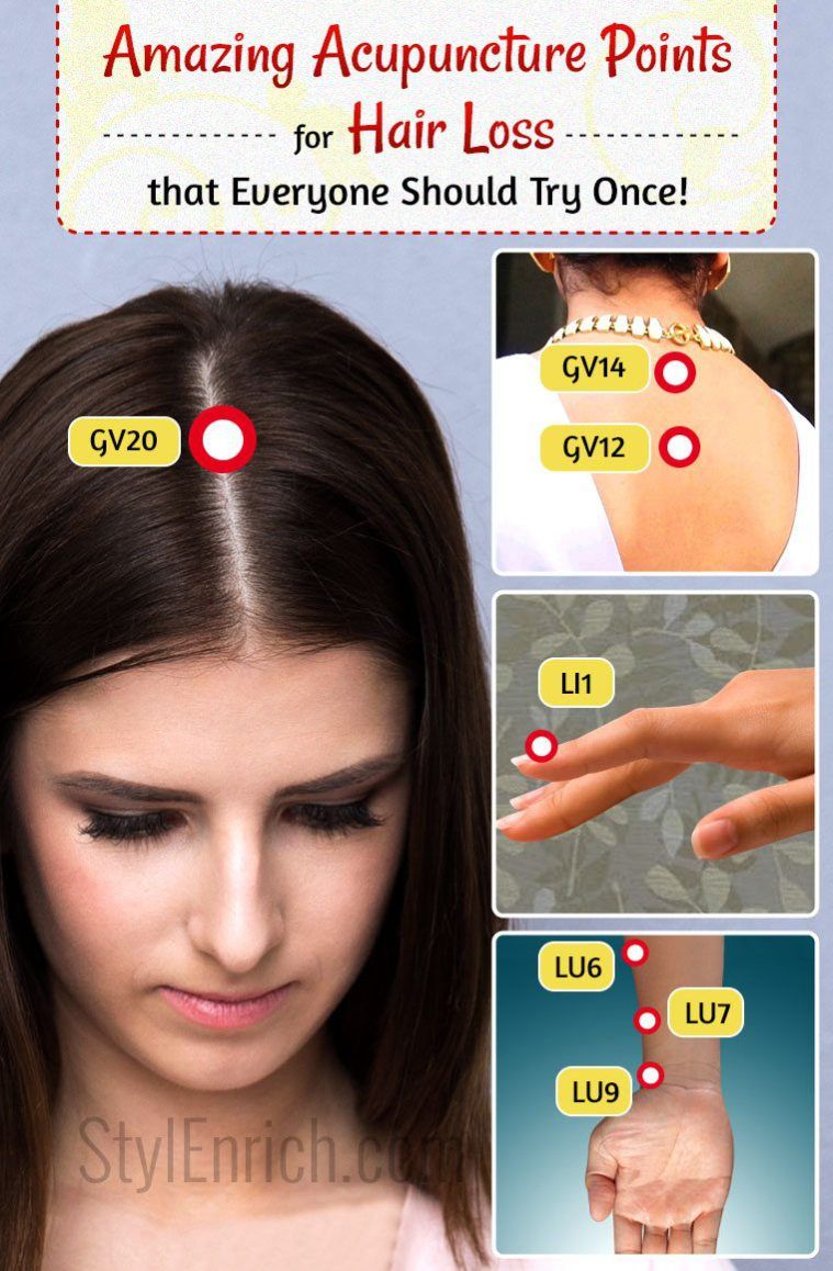 Acupuncture for hair loss