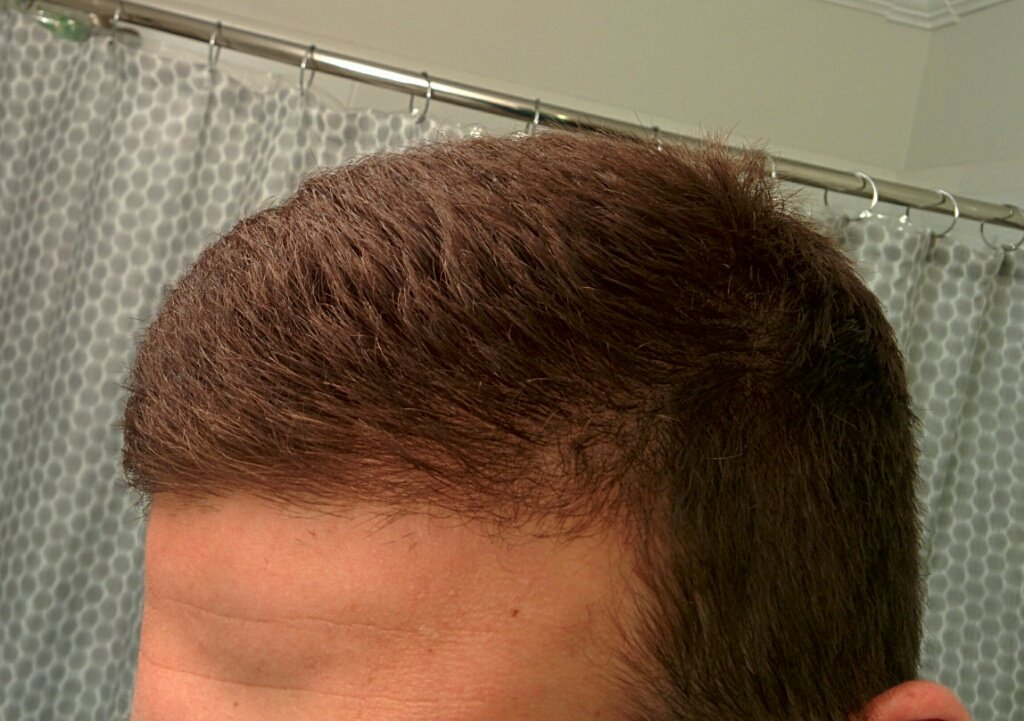 Almost 30 years old.is my hair thinning?