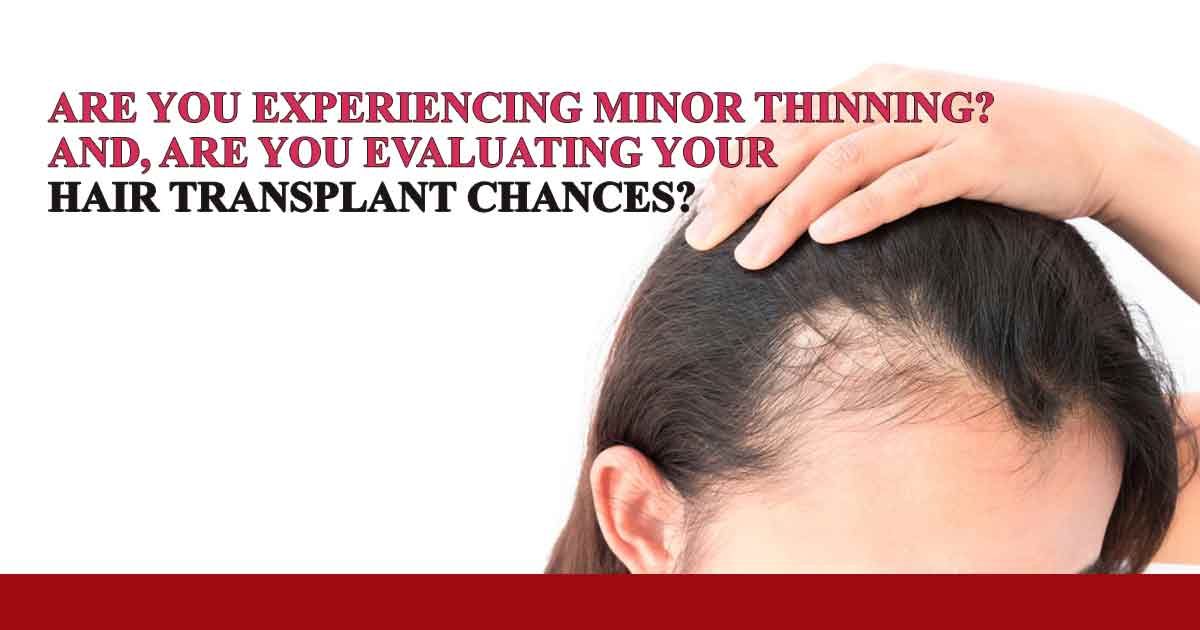 Are You Experiencing Minor Thinning? And, Are You ...