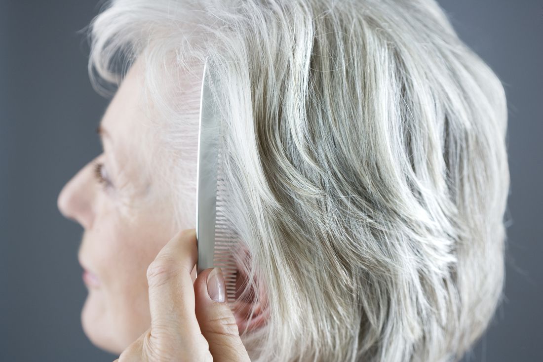 Arthritis Medications May Cause Hair Loss