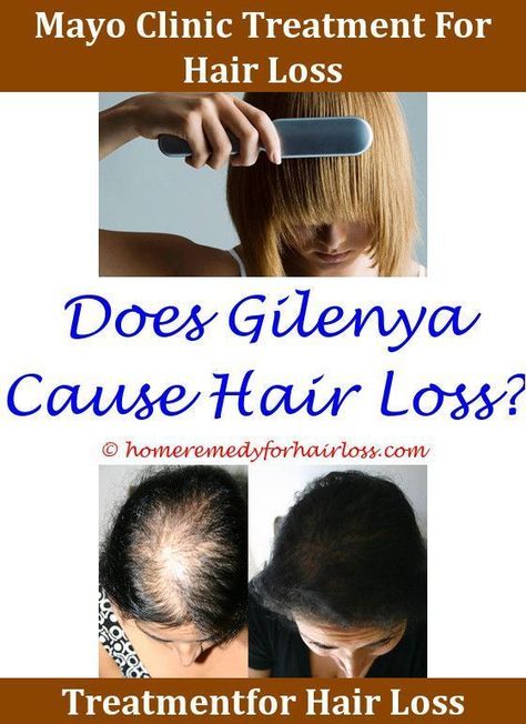 Best 25+ Sudden hair loss ideas on Pinterest
