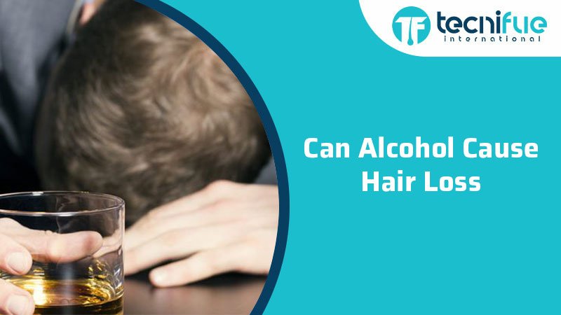 Can Alcohol Cause Hair Loss? » TecniFUE International