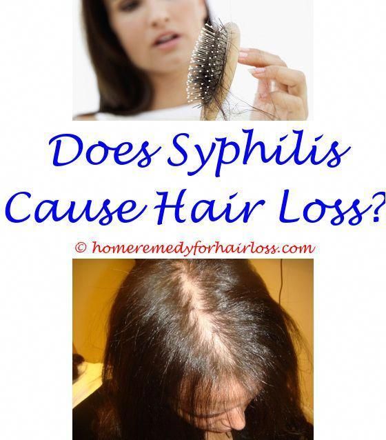 can loss of vitamin d cause hair loss