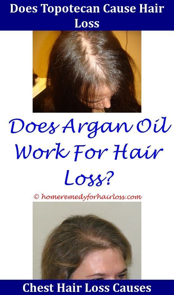 Can Progesterone Stop Hair Loss,Hair Loss tight braids and ...