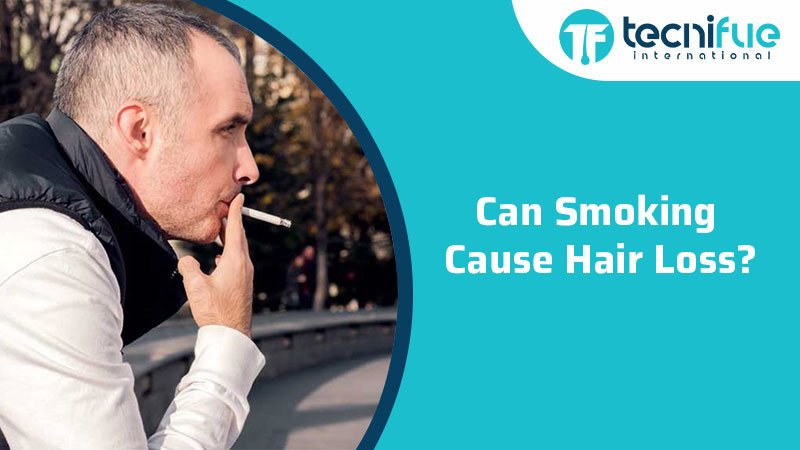 Can Smoking Cause Hair Loss? » TecniFUE International