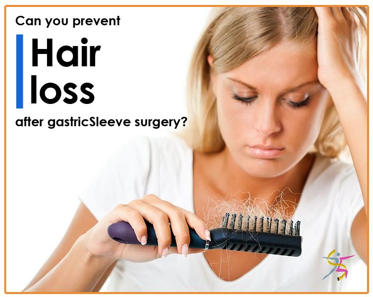 Can you prevent hair loss after #gastricSleeve surgery? Share ideas on ...