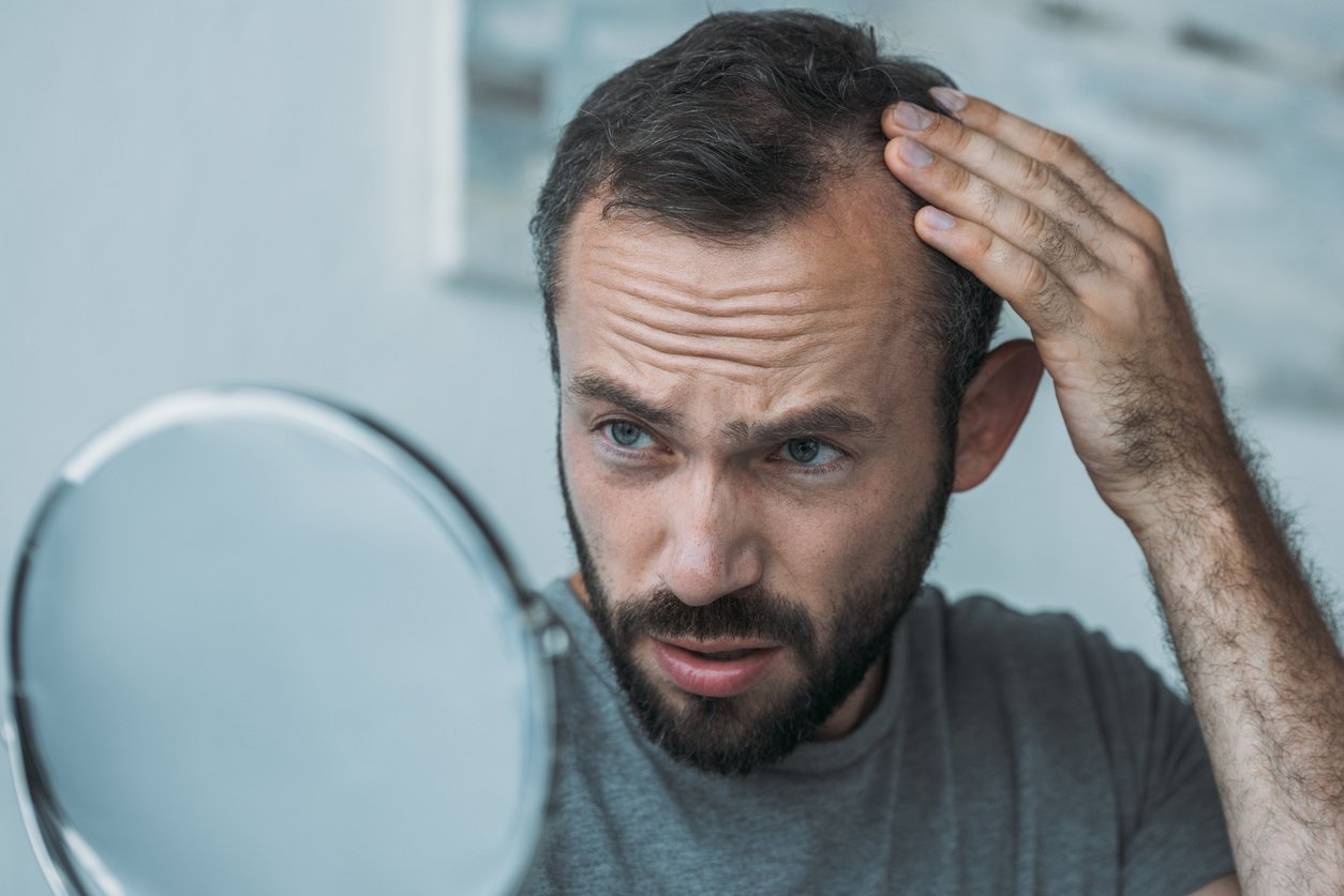 Can You Reverse Hair Loss?