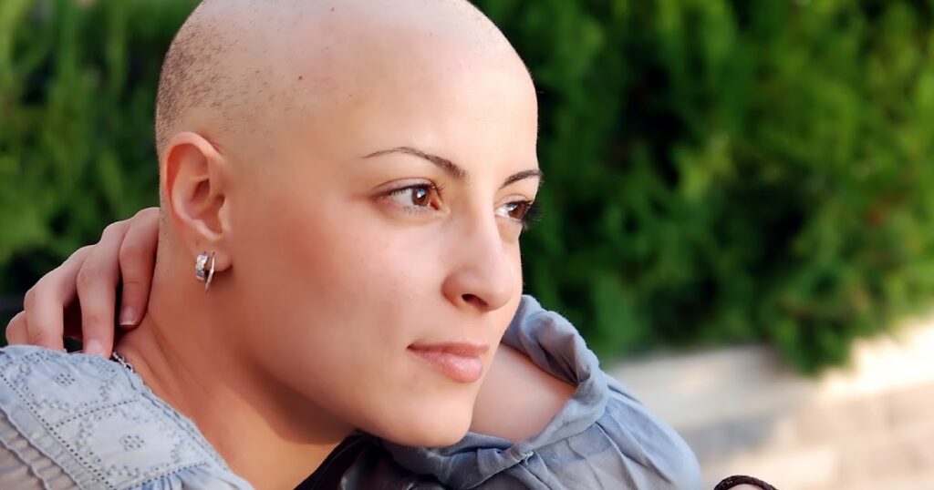Cancer Treatment and Hair Loss: The Connection
