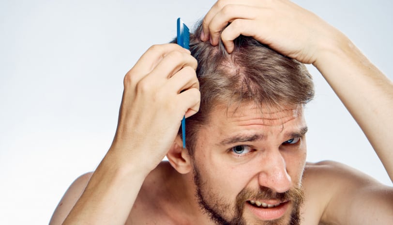 Causes and Risk Factors for Thinning Hair You Should Know
