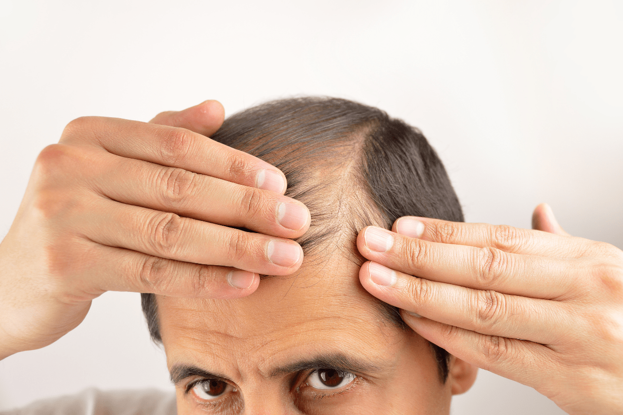 Causes Of Excessive Hair Loss