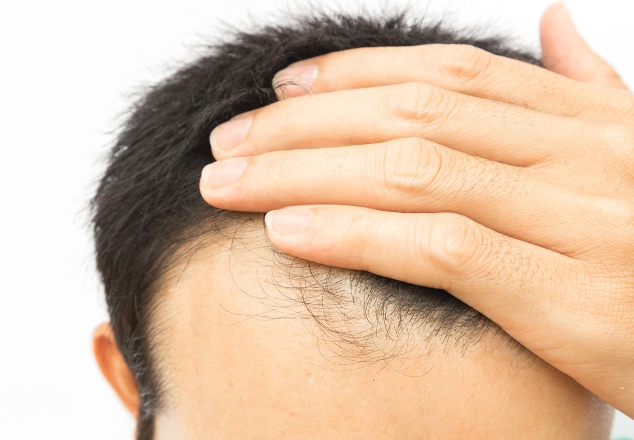 Causes of Hair Breakage Around Hairline and Tips to ...