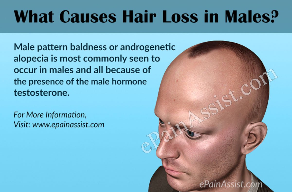 Causes of Hair Loss in Males, Females, Children