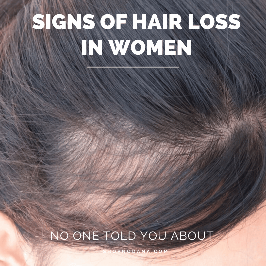 Causes Of Hair Loss In Women