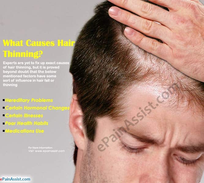 Causes Of Thinning Hair