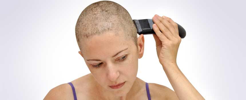 Chemo &  Hair Loss