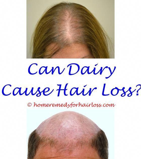 Copper Deficiency Hair Loss