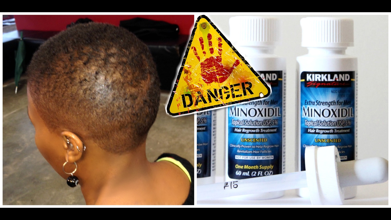 Danger of Minoxidil / Rogaine Treatment