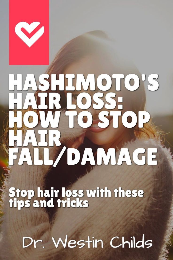 Dealing with Hair Loss from Thyroiditis (Hashimoto