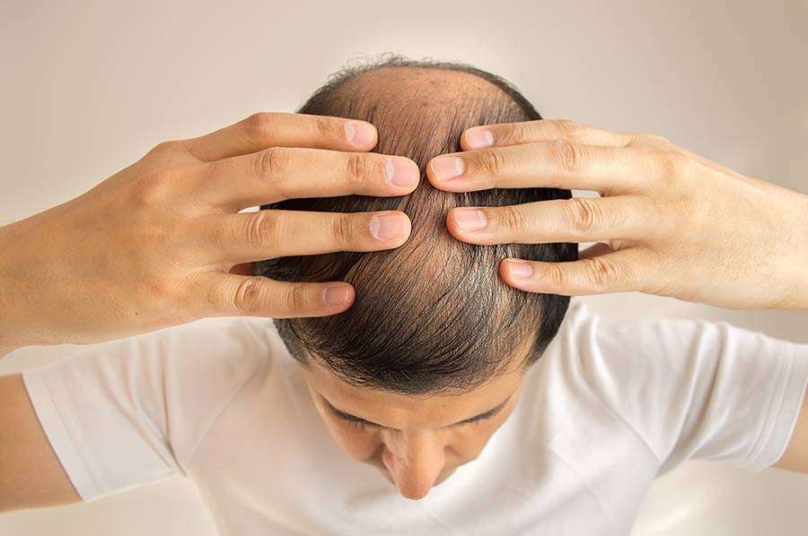 Detumescence Therapy for Hair loss: Does it Actually Work?