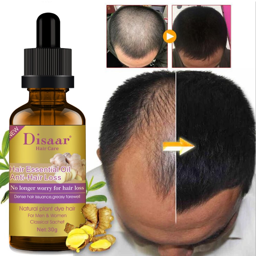 Disaar Hair Growth Oil &  Disaar Hair Regrowth Shampoo â 2 in 1 Pack ...