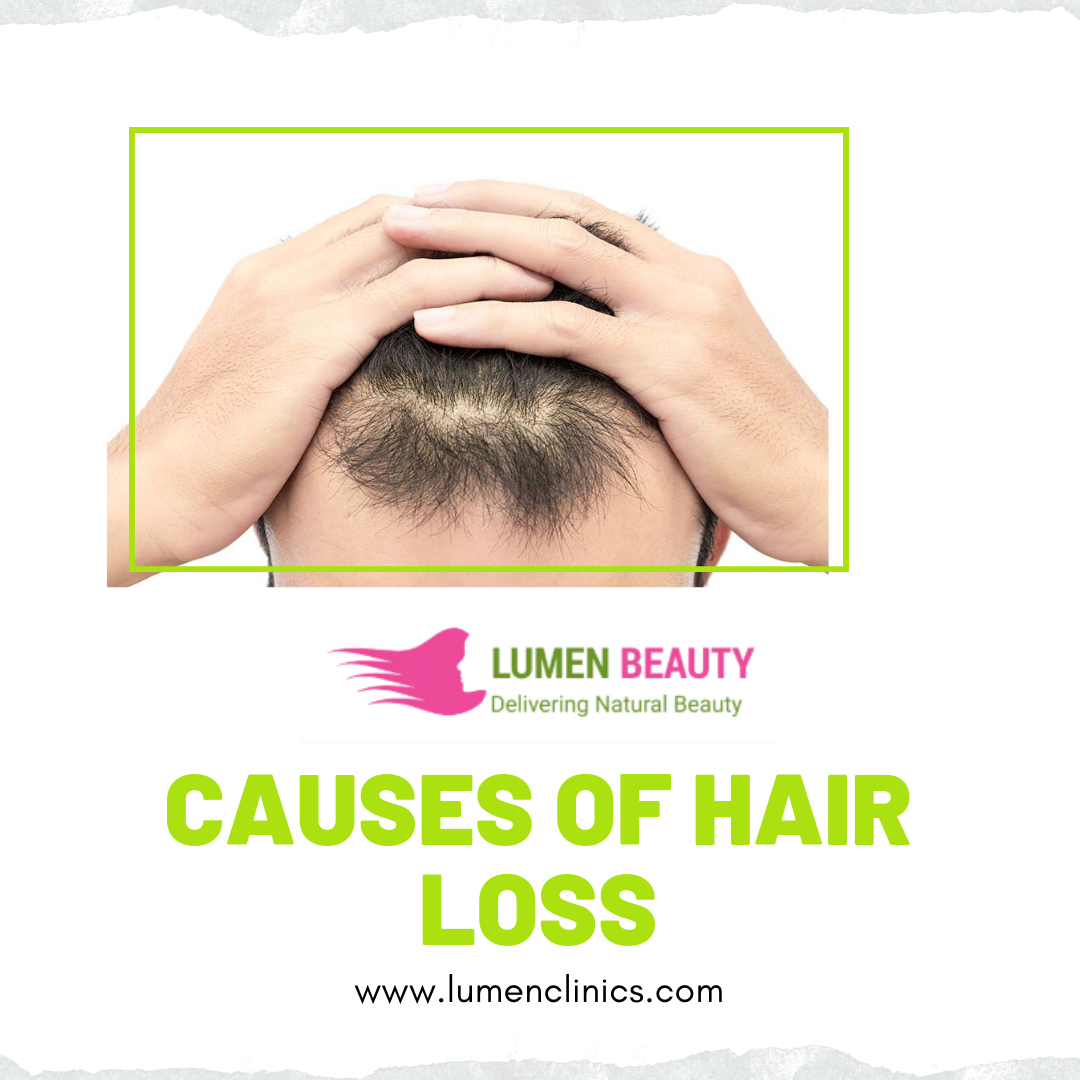Discover your hair loss causes and treatments as well as ...