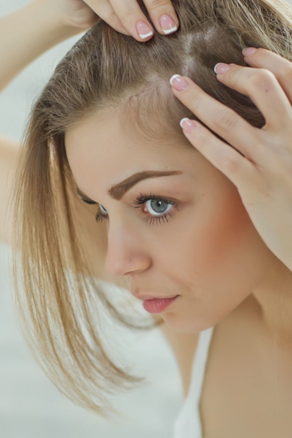 Do You Have Lice Or Dandruff? Learn The Difference ...