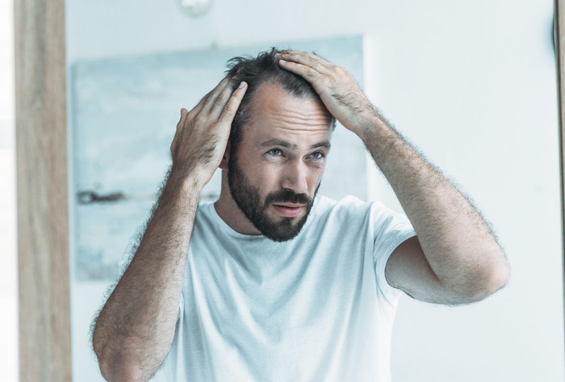 Does Creatine Cause Hair Loss? Here