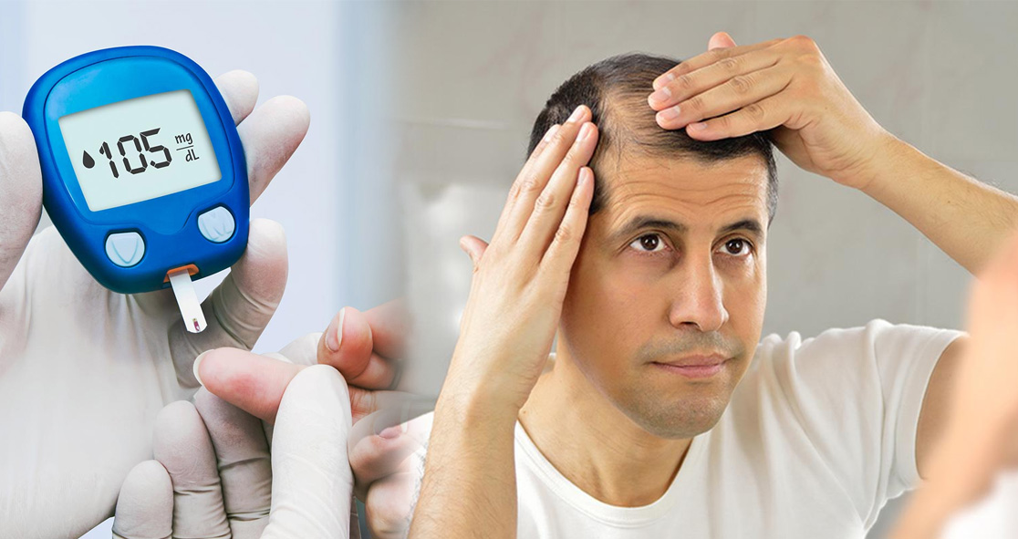 Does Diabetes Cause Hair Loss?  Myhealthyclick.com