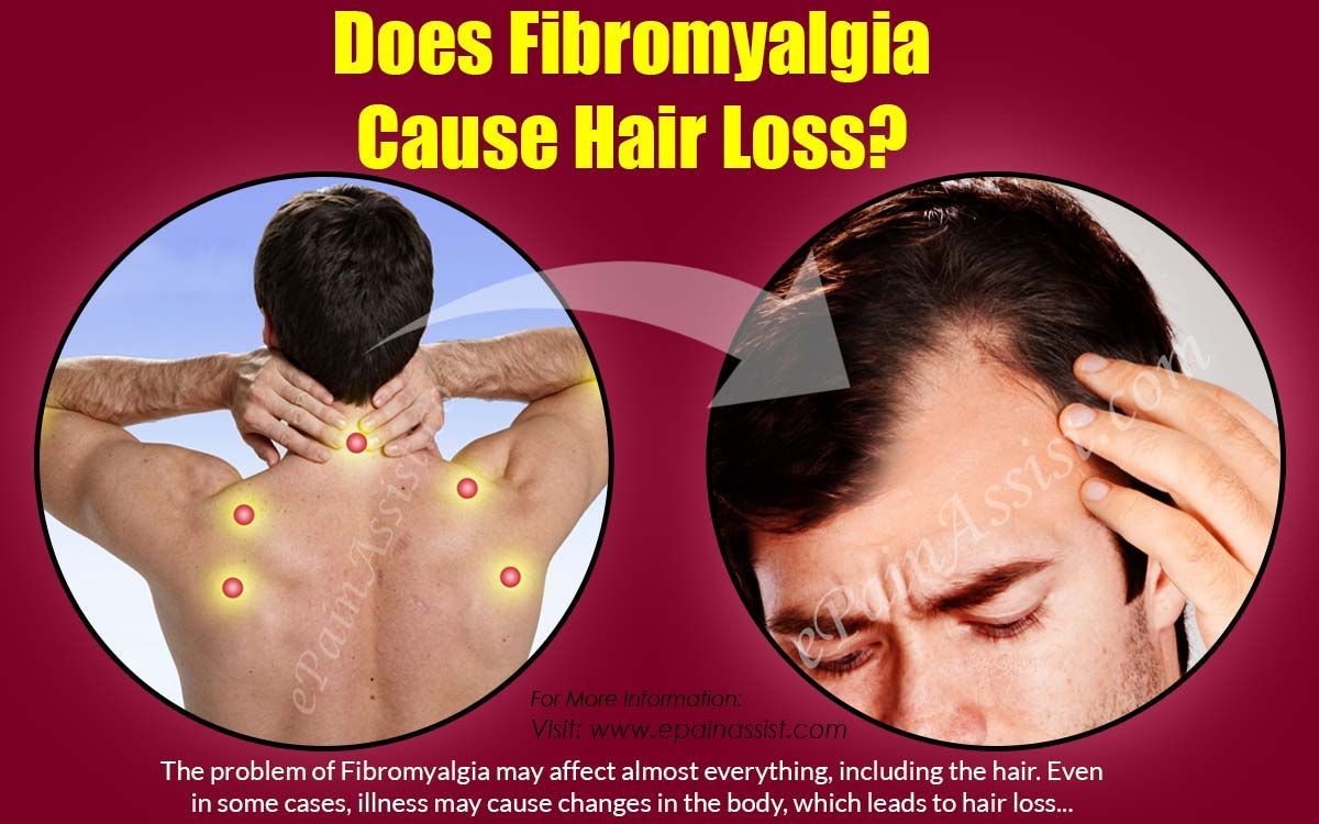 Does Fibromyalgia Cause Hair Loss?