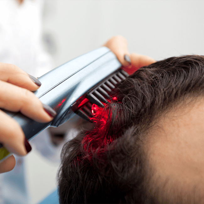 Does Laser Therapy for Hair Growth Work?